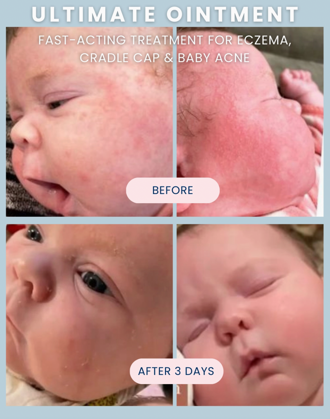 A promotional before-and-after collage for an ointment, showing close-up views of a baby's face and cheek in four quadrants. The top-left panel shows a baby with red, irritated skin labeled 'BEFORE,' and the bottom-right panel shows the same area calmer and less red after 3 days, labeled 'AFTER 3 DAYS.
